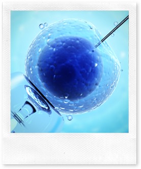 Artificial insemination